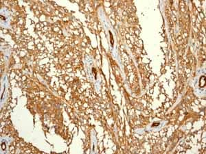 Anti-CD146 antibody [EPR3208](ab75769)