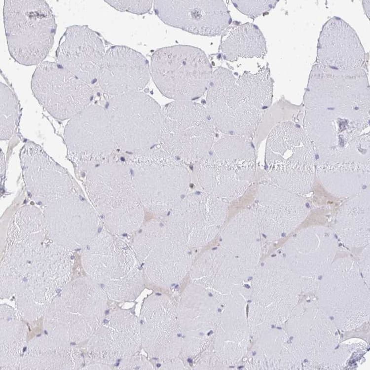 Riok1 Rio1 Antibody Ab254723  Immunohistochemistry Formalin Pfa Fixed Paraffin Embedded Sections Img120025