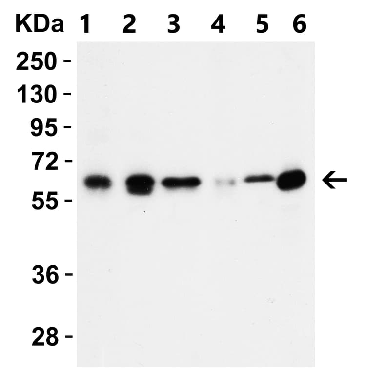 Anti-SQSTM1 / p62 antibody(AB91526)