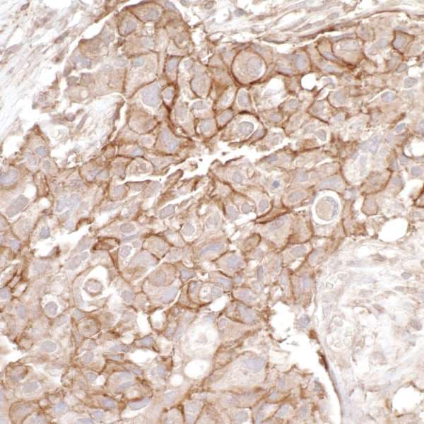 Anti-CD44 antibody(AB157107)