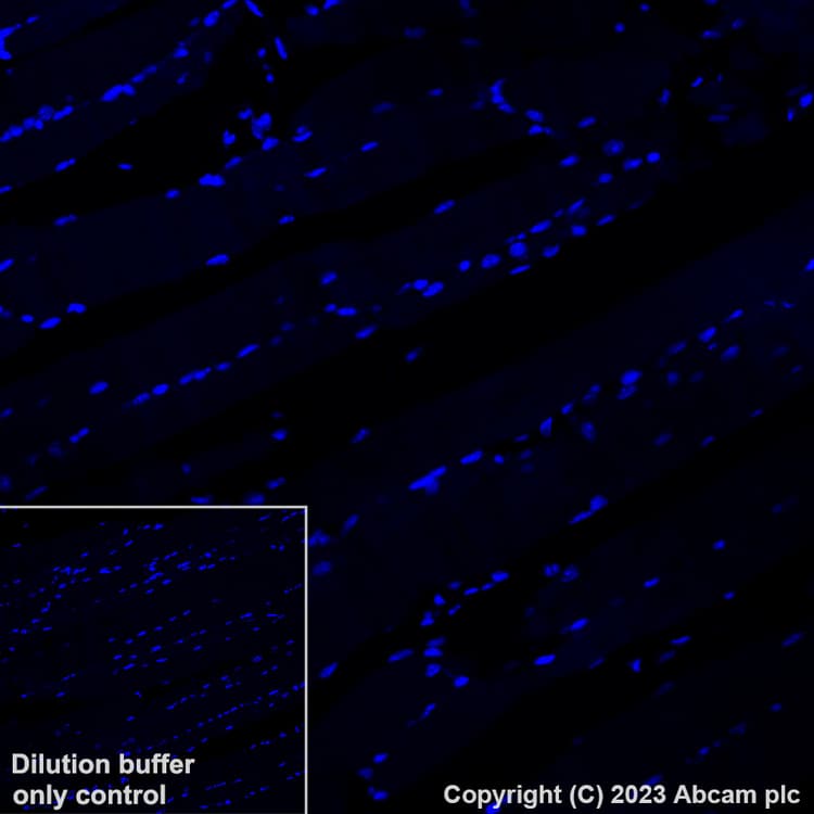 Alexa Fluor® 647 Anti-TBR2 / Eomes antibody [EPR19012](AB315356)