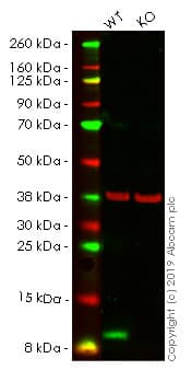 Anti-S100A4 antibody [EPR14639(2)](AB197896)