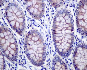 Grasp65 Antibody Epr12439 Bsa And Azide Free Ab249824  Immunohistochemistry Formalin Pfa Fixed Paraffin Embedded Sections Img120492