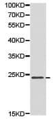 Cdkn3 Antibody Ab175393  Western Blot Img49709