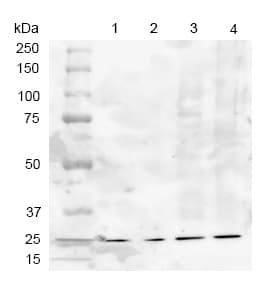 Anti-SOD2/MnSOD antibody(AB13534)