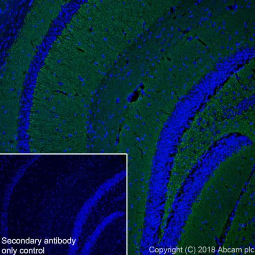 Anti-VGluT1 antibody [EPR22269](ab227805)