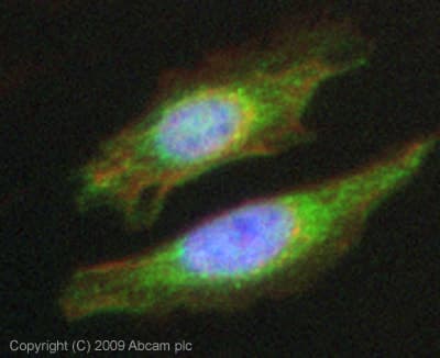 Anti-ALK-1 antibody(AB68703)