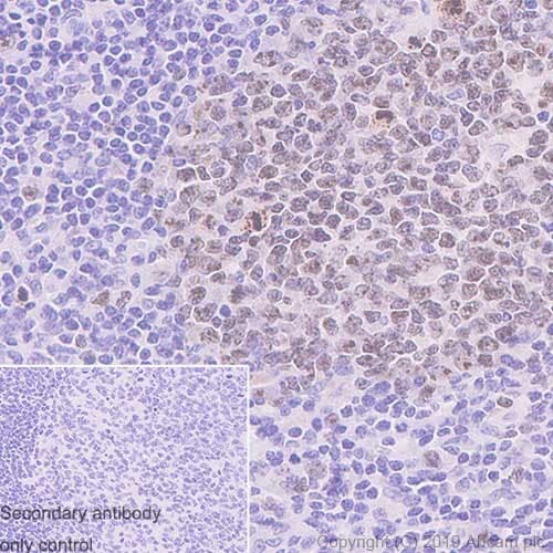 Anti-Ki67 antibody [37C7-12](AB245113)