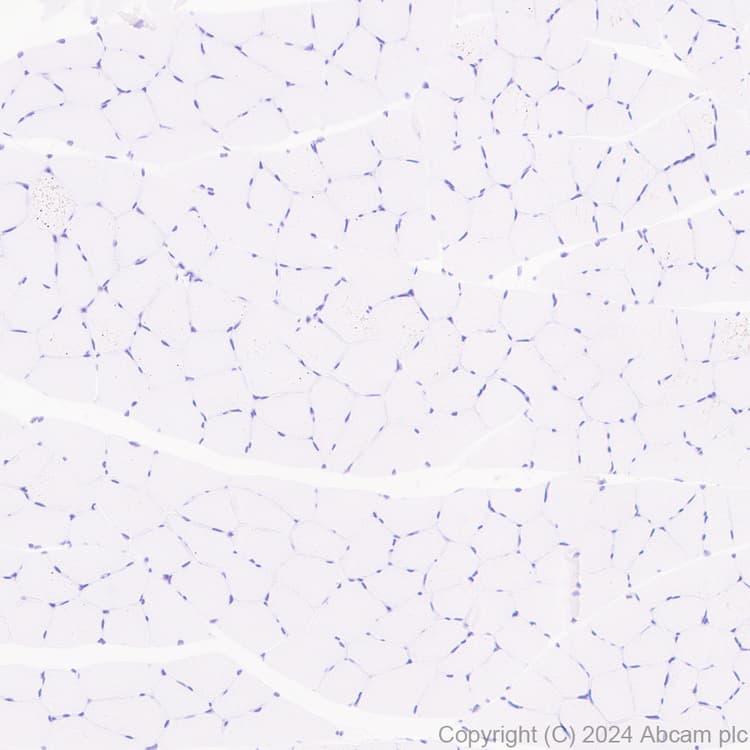 Lox 1 Antibody Epr27871 67 Bsa And Azide Free Ab317690  Immunohistochemistry Formalin Pfa Fixed Paraffin Embedded Sections Img432112