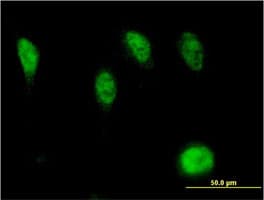 Anti-RUNX2 antibody [2B9](AB76956)