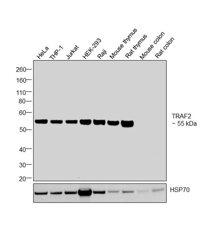 Anti-TRAF2 antibody [RP23040169](AB308019)