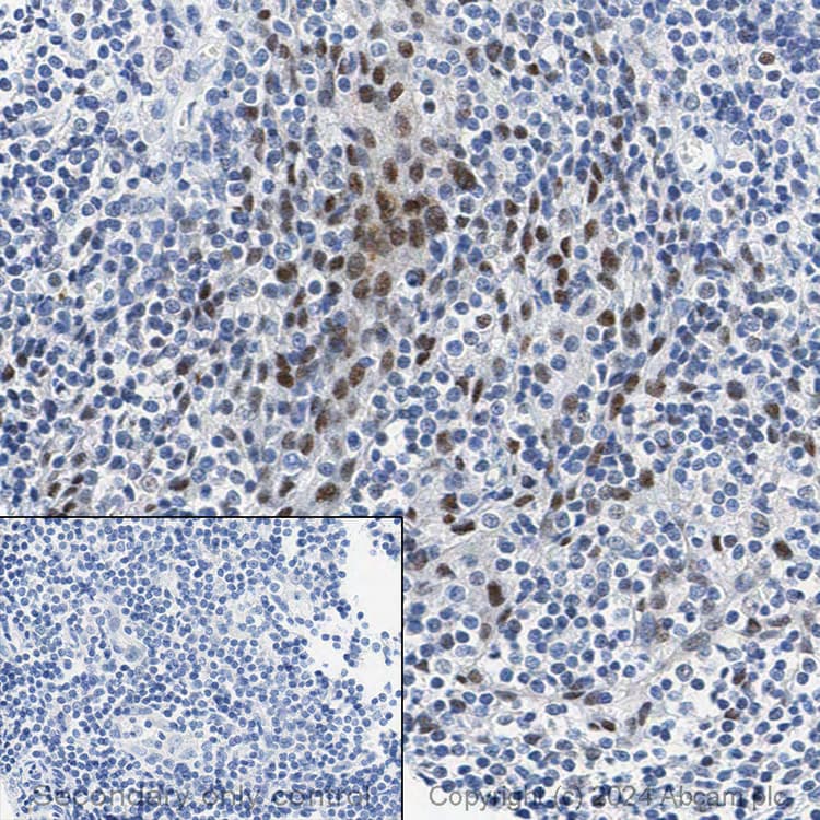 Anti-BRG1 antibody [EPR3912](AB108318)