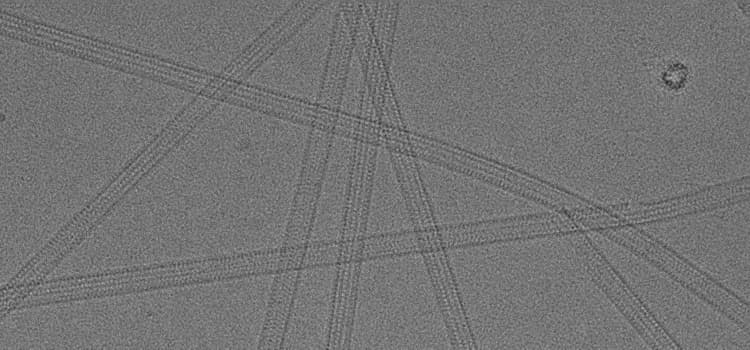 Microtubules 20000x Kid21767879