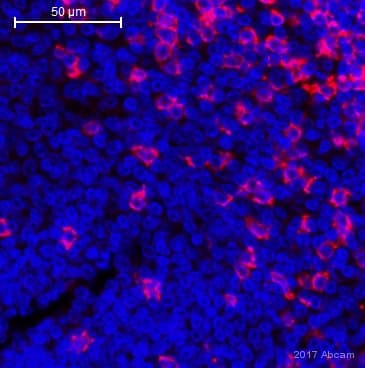 Anti-CD8 alpha antibody [C8/144B](AB17147)