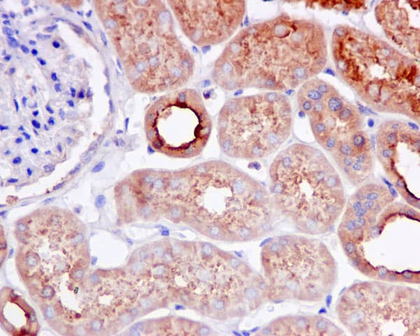 Kbtbd11 Antibody Epr100562b Bsa And Azide Free Ab249501  Immunohistochemistry Formalin Pfa Fixed Paraffin Embedded Sections Img115636