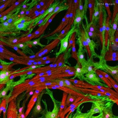 Anti-TAGLN/Transgelin antibody(AB14106)