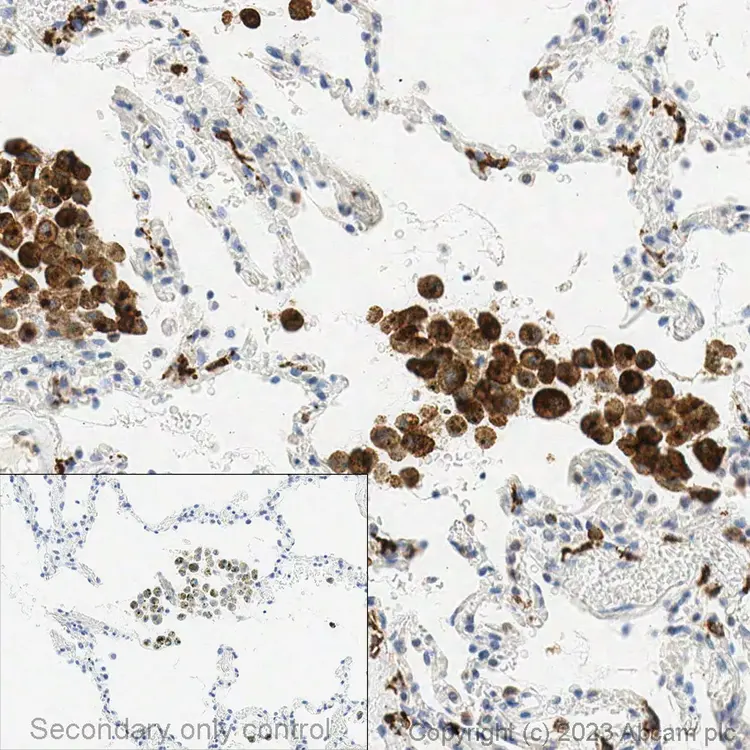 Anti-Mannose Receptor antibody(AB64693)