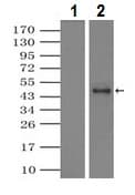Anti-alpha 1 Antitrypsin antibody [11G2](AB230695)