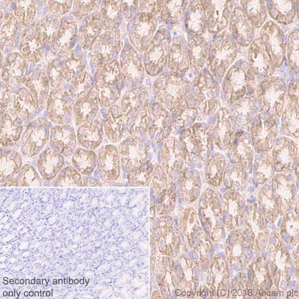 Anti-beta 2 Adrenergic Receptor antibody [EPR707(N)](AB182136)