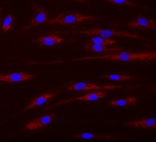 TMRM Assay Kit (Mitochondrial Membrane Potential)(AB228569)