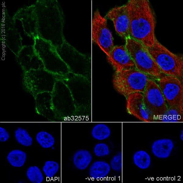 Anti-alpha smooth muscle Actin (acetyl E3) + ACTG2 (acetyl E3) antibody [E184](AB32575)