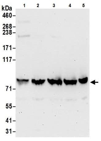 Anti-VPS35 antibody - C-terminal(AB226180)