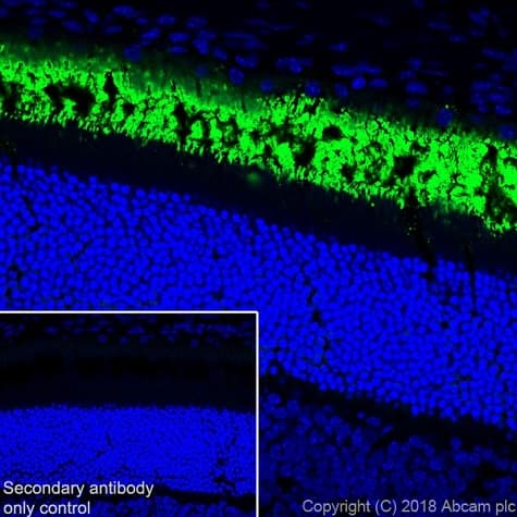 Anti-Rhodopsin antibody [EPR21876](AB221664)