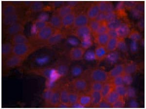 Anti-IGF1 Receptor antibody(AB131476)