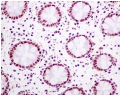 Anti-Tat-SF1 antibody [EPR9104(B)] - BSA and Azide free(AB248932)