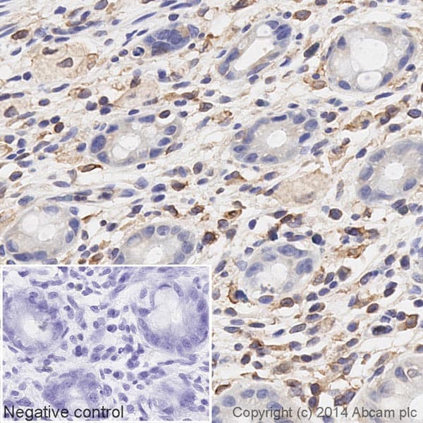 HRP Anti-Calnexin antibody [EPR3633(2)] - ER Membrane Marker(AB195198)