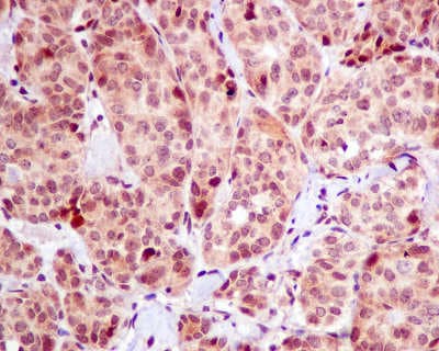 Kinesin Heavy Chain 2 Antibody Epr10740b Ab154868  Immunohistochemistry Formalin Pfa Fixed Paraffin Embedded Sections Img44907