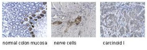 Anti-Synaptophysin antibody [SY38](AB8049)