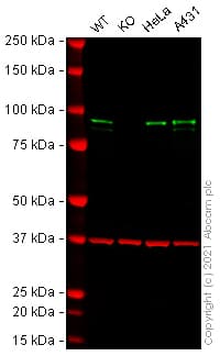 Anti-beta Catenin antibody [E247] - ChIP Grade(AB32572)