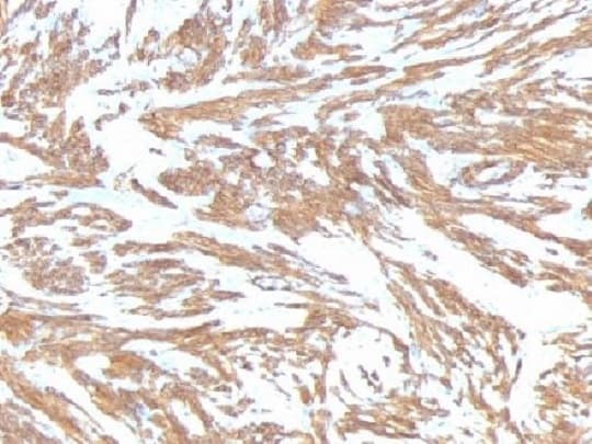 Anti-alpha smooth muscle Actin antibody [ACTA2/791](AB220179)