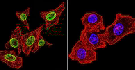 Anti-Parvalbumin antibody(AB11427)