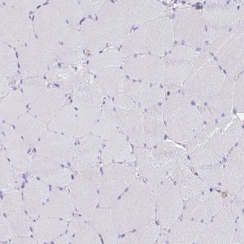 Anti-EPB41L1 antibody(AB244499)