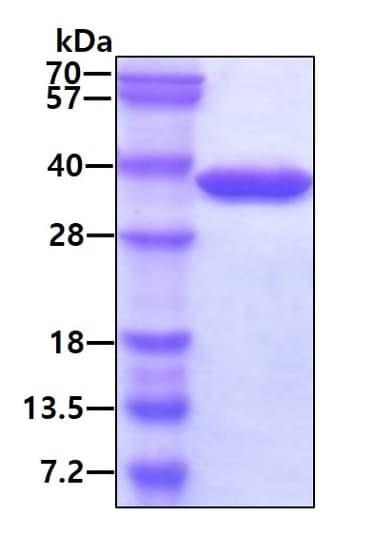 Ab101051  Sds Page Img416104