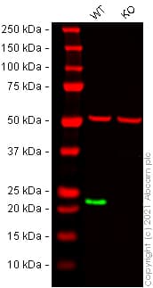 Anti-RAB7 antibody [EPR7589](AB137029)