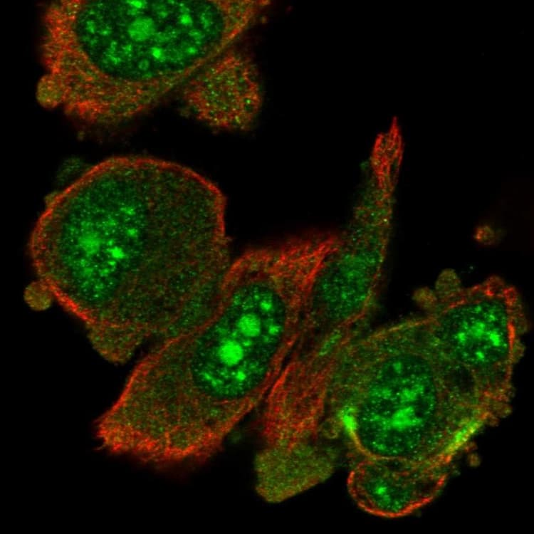 Riok1 Rio1 Antibody Ab254723  Immunocytochemistry Immunofluorescence Img122062