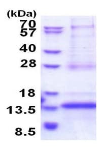 Recombinant Human CDKN2AIPNL protein(AB177647)