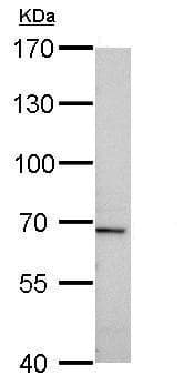 Anti-Tissue Plasminogen Activator antibody(AB227069)