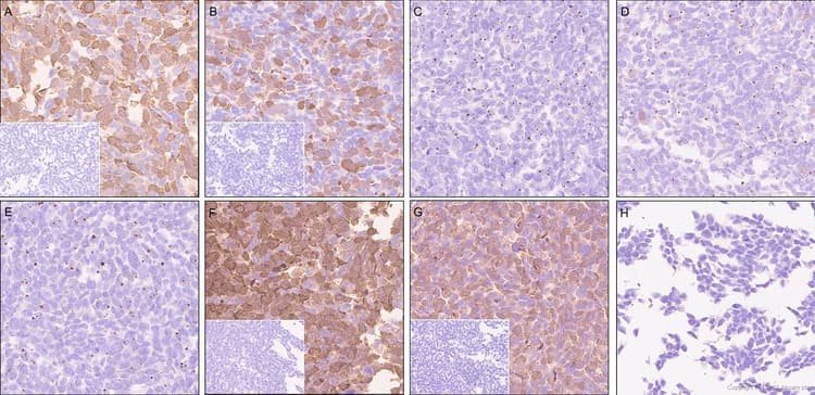 Anti-Ras (mutated Q61R) antibody [SP174](AB227658)