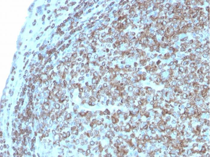 Anti-CD74 antibody [CLIP/3127R](AB270265)