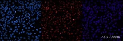 Anti-Ki67 antibody [MKI67/2465](AB238020)
