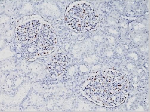 Anti-Wilms Tumor Protein antibody [WT1/857](AB220212)