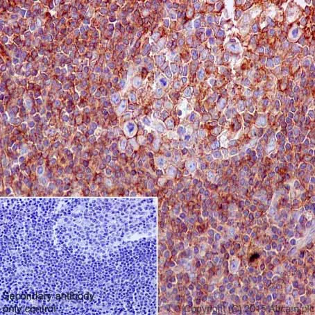 Anti-HLA A antibody [EP1395Y](AB52922)