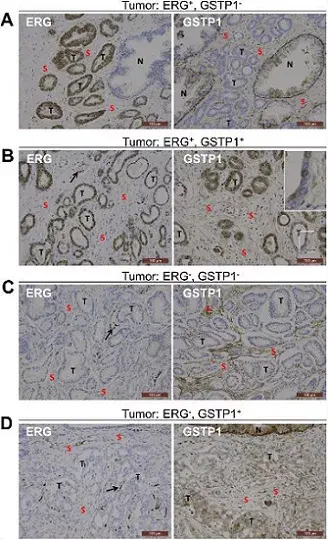 Anti-ERG antibody [EPR3864](AB92513)