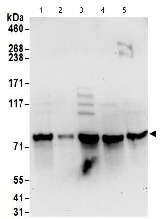 Anti-RBM14 antibody(AB70636)