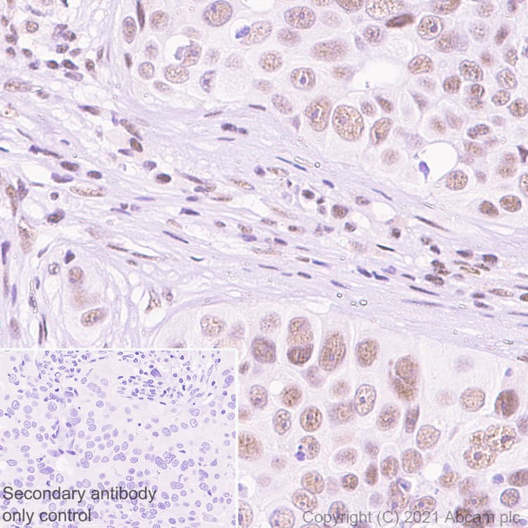 Ddx17 Antibody Epr13807b Ab180190  Immunohistochemistry Formalin Pfa Fixed Paraffin Embedded Sections Img166834