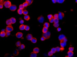 Munc18c Antibody Epr12447 Ab175238  Immunocytochemistry Immunofluorescence Img80864